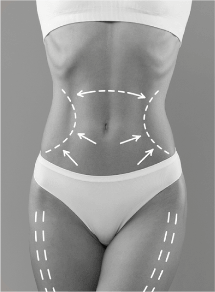 Cirurgia Plástica